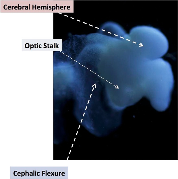 First Almost Fully-Formed Human Brain Grown in Lab